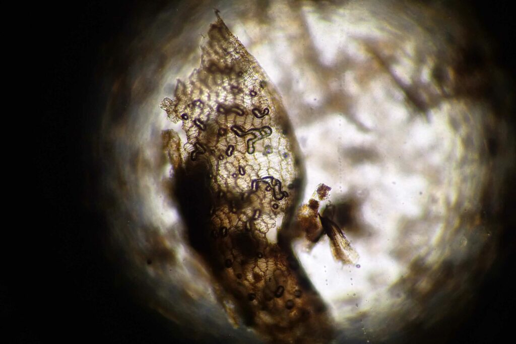sphagnum moss under a microscope